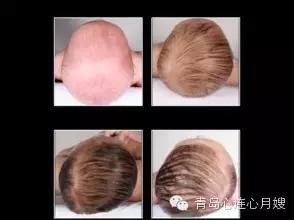 宝宝头睡偏了怎么补救,一岁宝宝头睡偏了怎么办