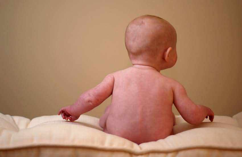 婴幼儿皮肤疹的处理方法,幼儿皮肤干燥起疹怎么办