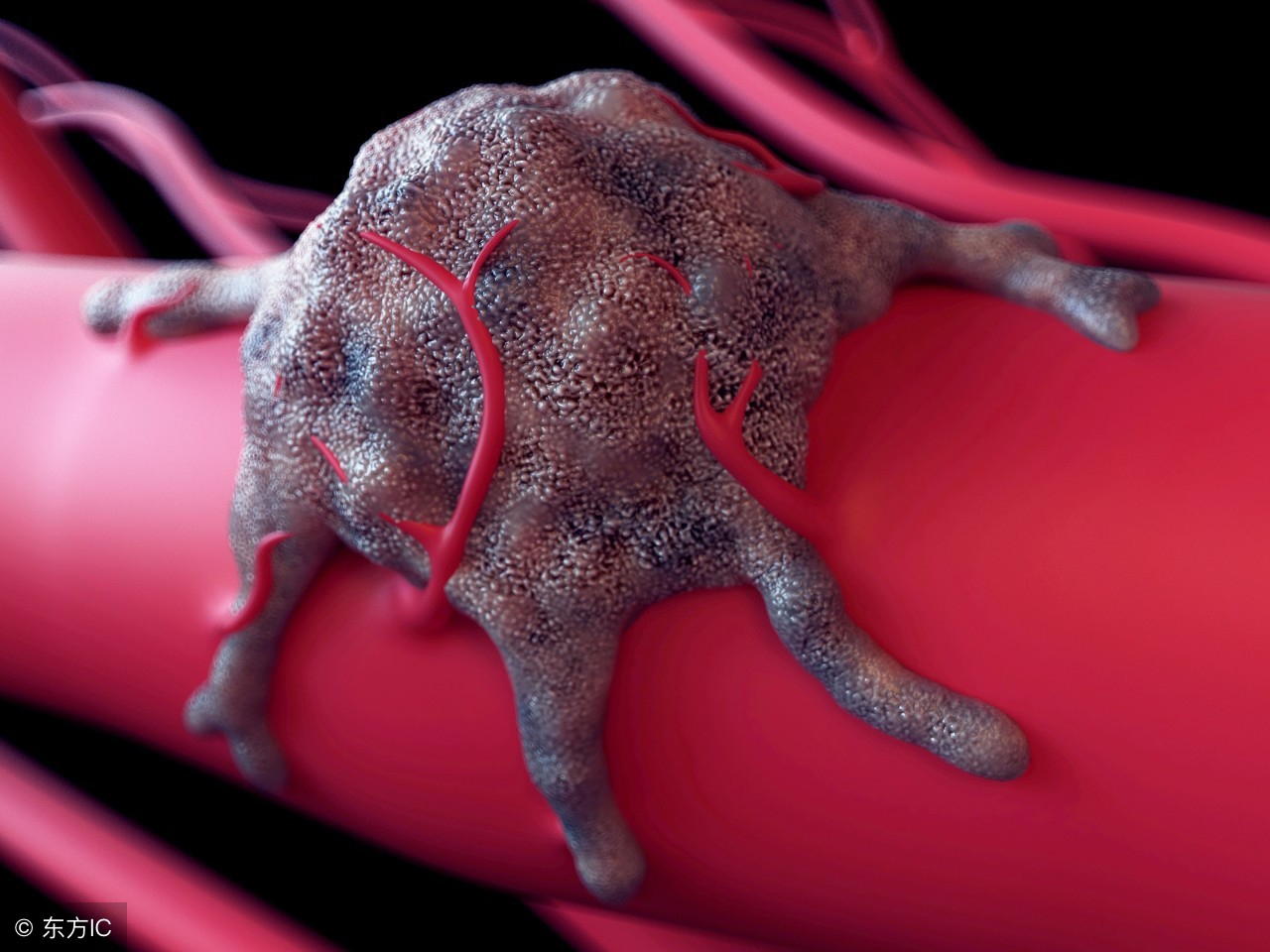 伽马刀与传统放疗相比,伽玛刀与放疗的区别是什么