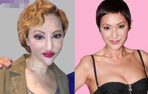 香港最老明星整容失败照片对比,整容失败的明星有哪些
