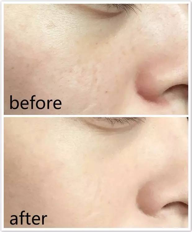 气垫bb推荐公认好用的,气垫BB怎么用不掉粉