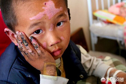 燃放烟花爆竹的防火措施,燃放烟花爆竹如何注意安全