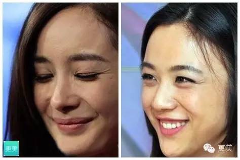 当青春变成了鱼尾纹,青春鱼尾纹