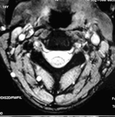 宣武医院头痛专家排名,宣武医院治疗头痛