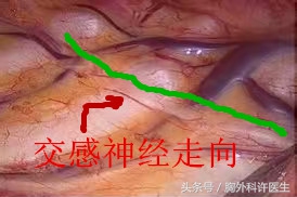 你说啥?手上多汗也要开刀?