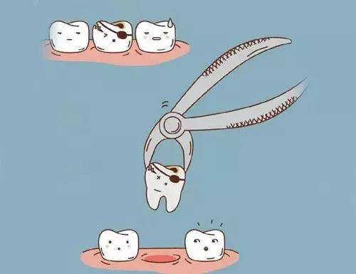 智齿不拔的危害有哪些,智齿的危害及拔除