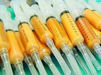 自体脂肪填充川字纹保持多久,自体脂肪填充10天内效果图