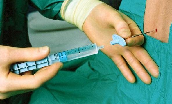 初产妇侧切分娩第二产程有多久,顺产侧切伤口医生没给缝合