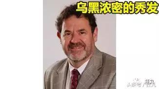 麦当劳薯条治疗脱发,麦当劳薯条掉头发