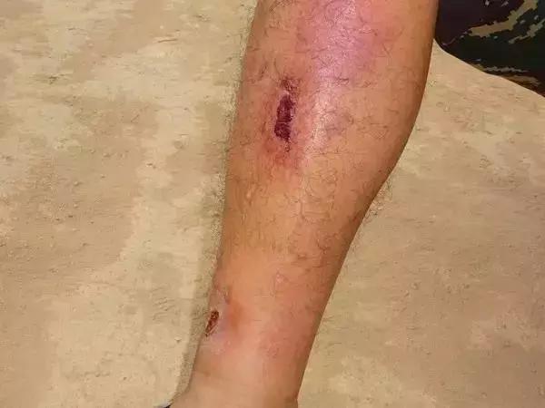 部队比赛拿奖怎么发朋友圈,部队士兵得奖怎么发朋友圈