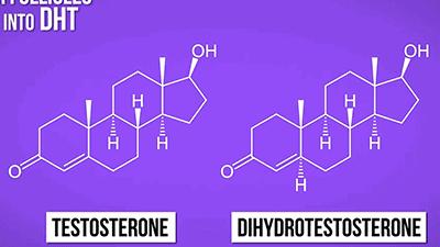 日本研究秃顶,日本教授秃头研究