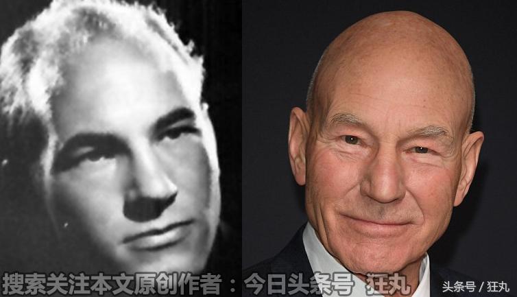 麦当劳薯条治疗脱发,麦当劳薯条掉头发