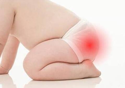 一招让宝宝红屁屁,如果宝宝屁屁经常红可以用什么