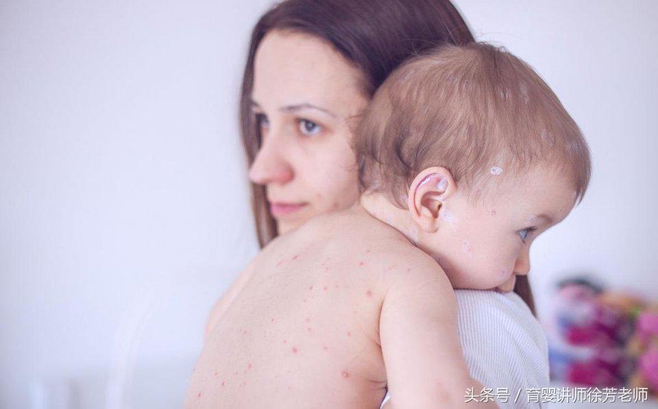 宝宝换了新奶粉身上起疙瘩,换奶粉后身上起红点点