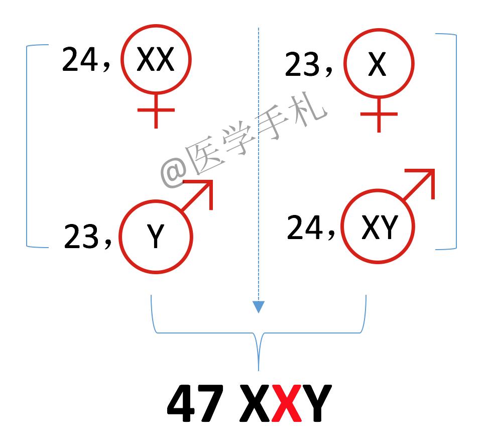 克氏综合征的人染色体会缺失吗,克氏综合征是染色体多吗