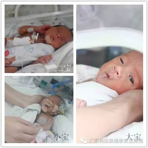 自然受孕怀上异卵三胞胎,自然受孕三胞胎完整版