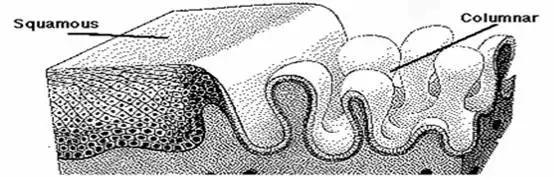千万别做宫颈糜烂手术,被医院忽悠做了宫颈糜烂治疗