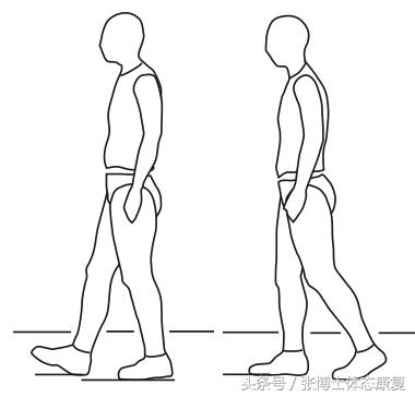 acl前交叉韧带重建康复,acl韧带重建