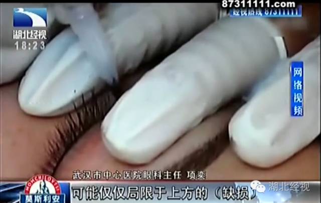 吓人！还敢在街边烫睫毛、纹眼线？看看这个武汉妹纸吧...