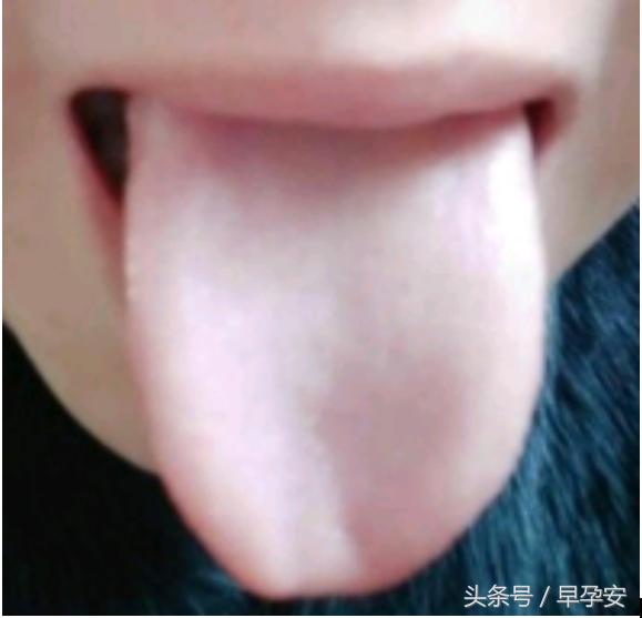 孕吐喝什么饮料才缓解孕吐,孕吐怎么缓解对胎儿有影响吗