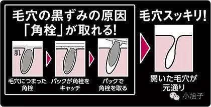 顽固草莓鼻怎么改善,消除草莓鼻的最快方法美容院