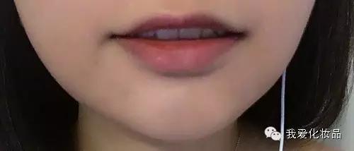 油皮痘肌适合的护肤品牌子,混油皮痘肌适用的护肤品推荐