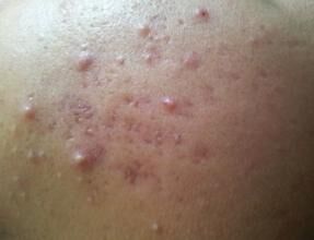 农历五月是毒月,农历五月毒月可信吗