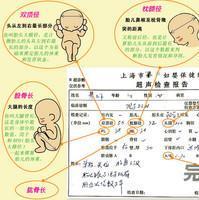 孕妈b超单怎么看,如何看懂b超影像里哪个是胎儿