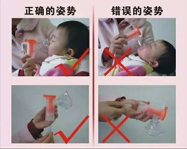 雾化吸入法操作的常见并发症,小儿雾化吸入的误区