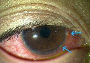 戴美瞳出事的视频,出事故的时候戴美瞳