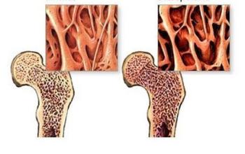 牙齿隐约痛医生怎么检查,牙齿疼马上看医生