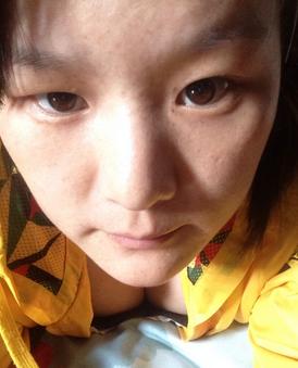 眼角雀斑要怎么消除,最近眼角长了雀斑是怎么回事