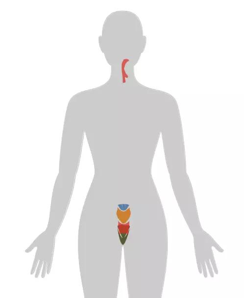 20张癌症人体地图告诉你致癌真相,2020癌症数据报告