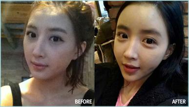 如何区分眼袋泪沟和卧蚕,如何区分眼袋和卧蚕泪沟