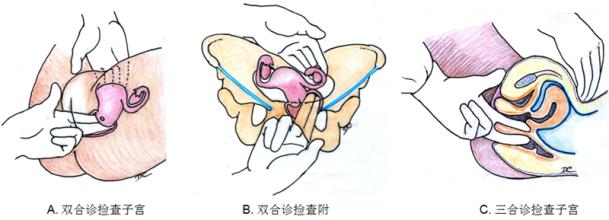 《妇科检查大全》及相关作用，女人，你值得拥有！