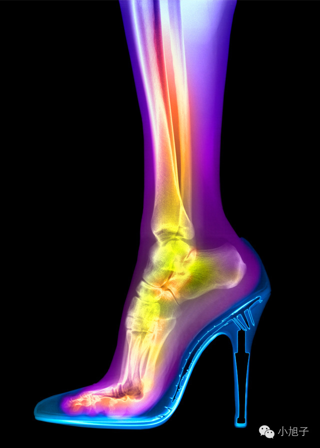 高跟鞋太高穿累脚怎么办,高跟鞋穿了不磨脚怎么办