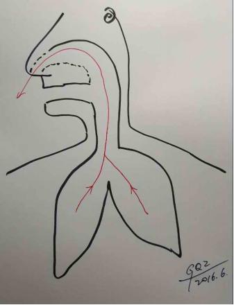 风吹流鼻涕是阳气不足吗,老是流鼻涕用什么提高抵抗力