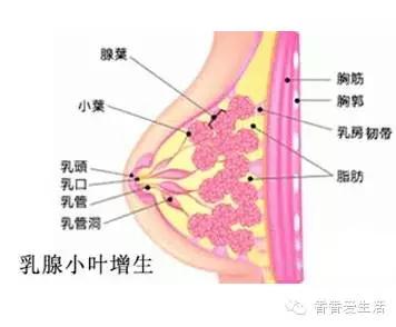 女性健康的杀手,乳腺增生的症状和原因