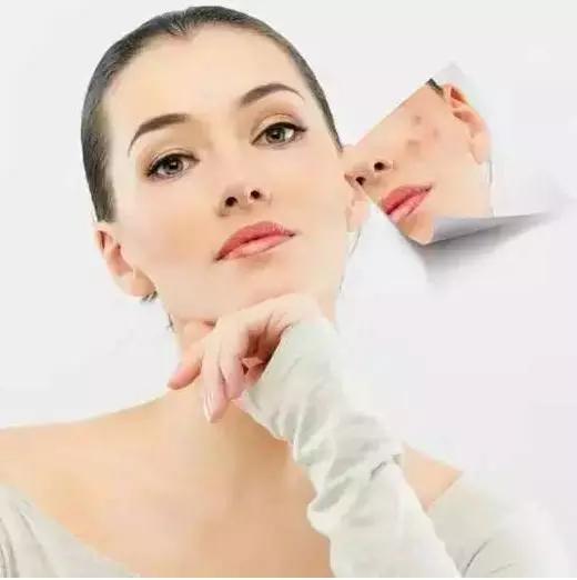 痘痘里面挤出来的白色东西是什么,闭合性粉刺挤出来白色有臭味