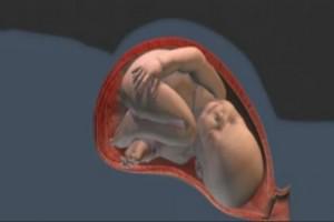 分娩时进行“剖腹产”手术全过程（附图）