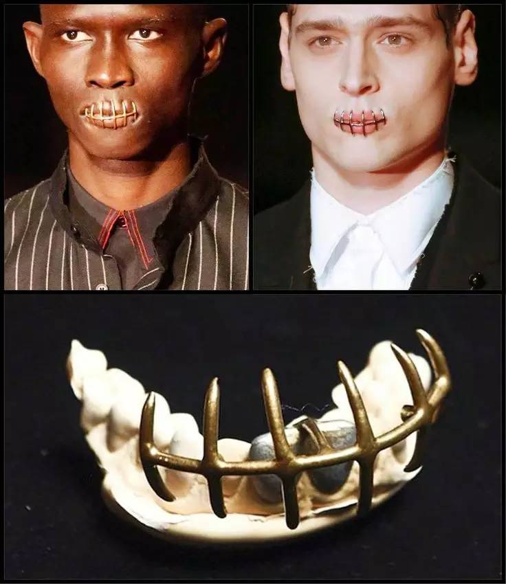 关于最近超火的金牙,你要知道这4件事(起码要知道怎么戴上去吧)