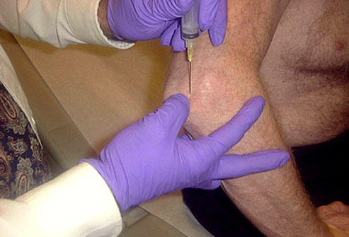 痛风的原因症状和治疗方法,痛风的原因症状