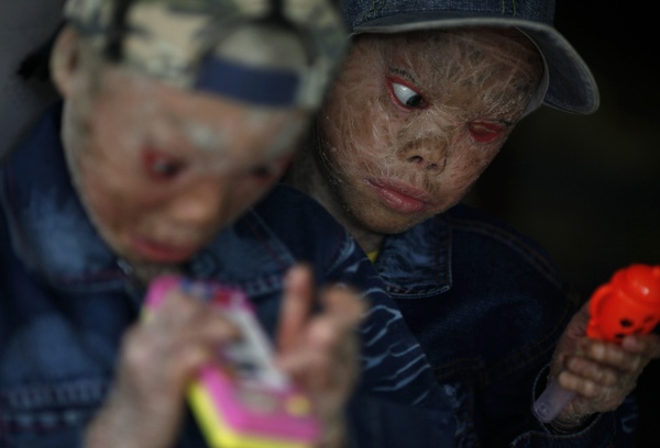 千古仅有：唐朝，火烧千家，术士临死献出中医治麻风病奇方保命