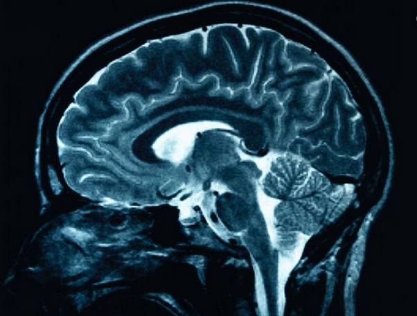 腰痛针灸放血疗法,糖尿病针灸放血疗法