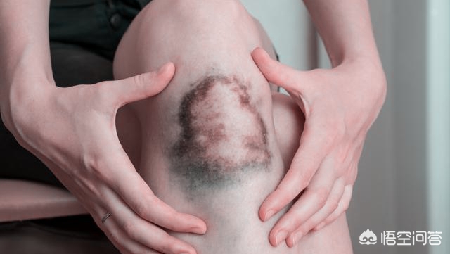 膝盖受伤如何做康复训练,运动康复膝盖疼痛