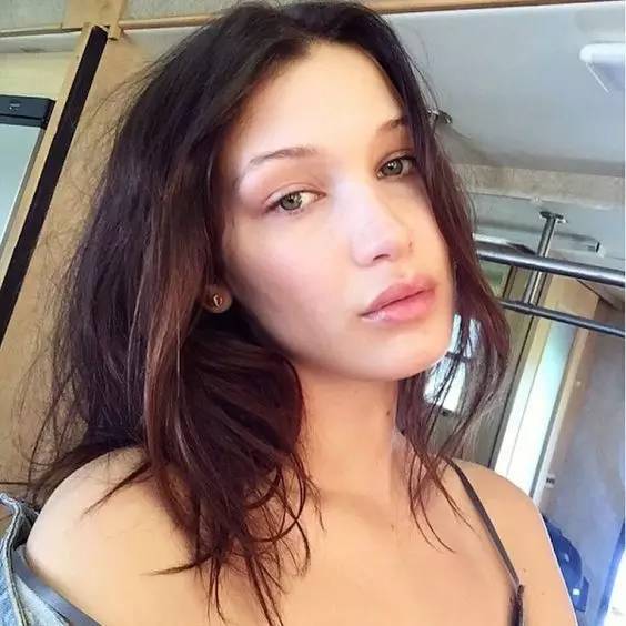 美容皮肤过敏最快缓解方法,护肤美容小妙招大热门