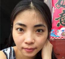 红糖祛斑的偏方有哪些呢,日常祛斑小方法轻松get