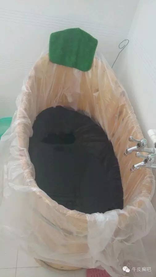 医院专家教你治疗牛皮癣,专家专治牛皮癣方法