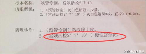 hpv检测e6e7阳性是什么意思,hpv检测阳性之后怎么办