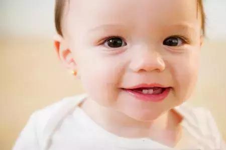 常见排齐牙齿的四大方法,牙齿拥挤重叠矫正过程